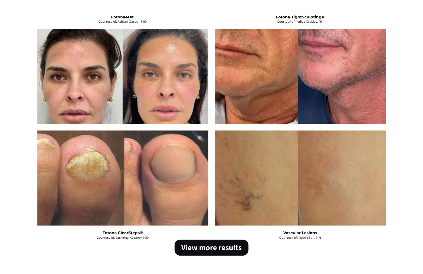 AES_CAP_DYNAMIS MAX PHY LANDING PAGE (14)-1