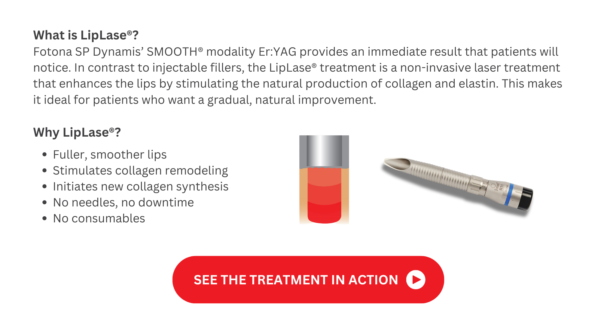 AES_CAP_FOTONA_LIPLASE LANDING PAGE (2)